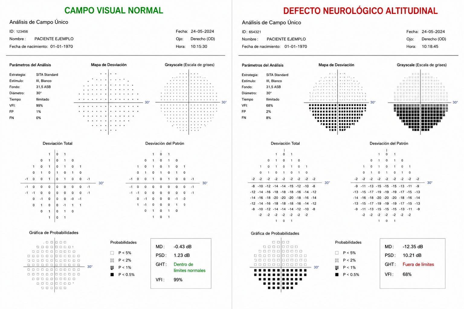Campo visual normal y defecto altitudinal