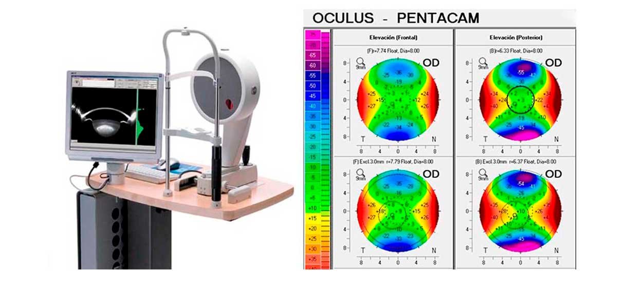 Pentacam